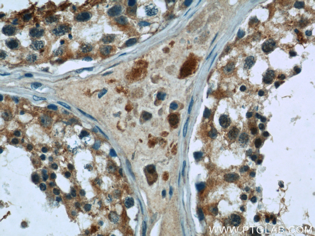 IHC staining of human testis using 24629-1-AP