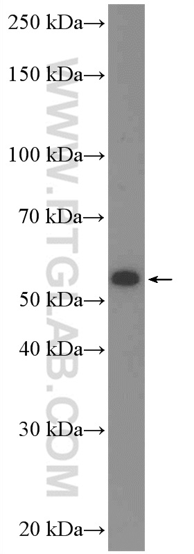 WB analysis of L02 using 24629-1-AP