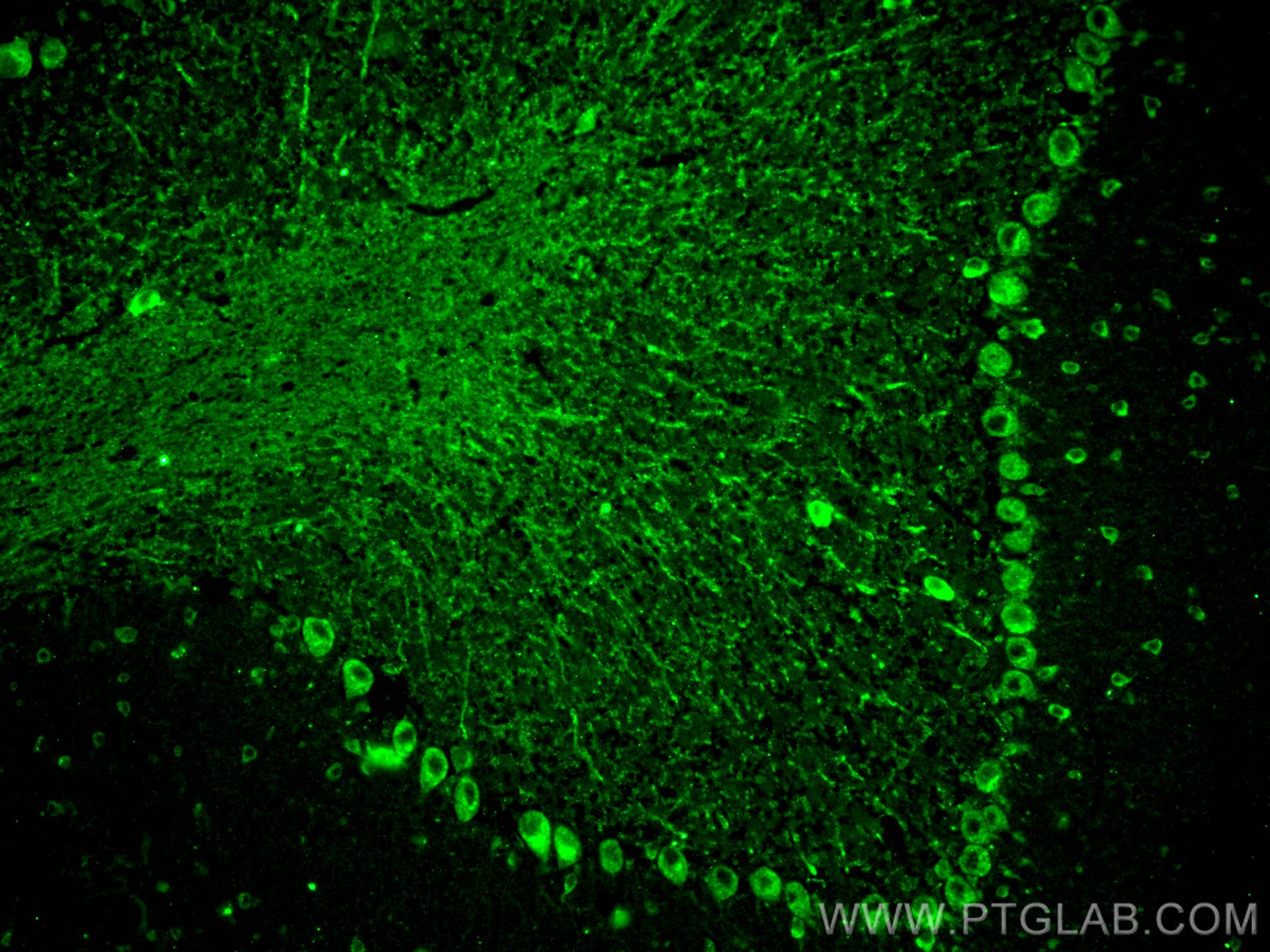 IF Staining of mouse cerebellum using 27603-1-AP