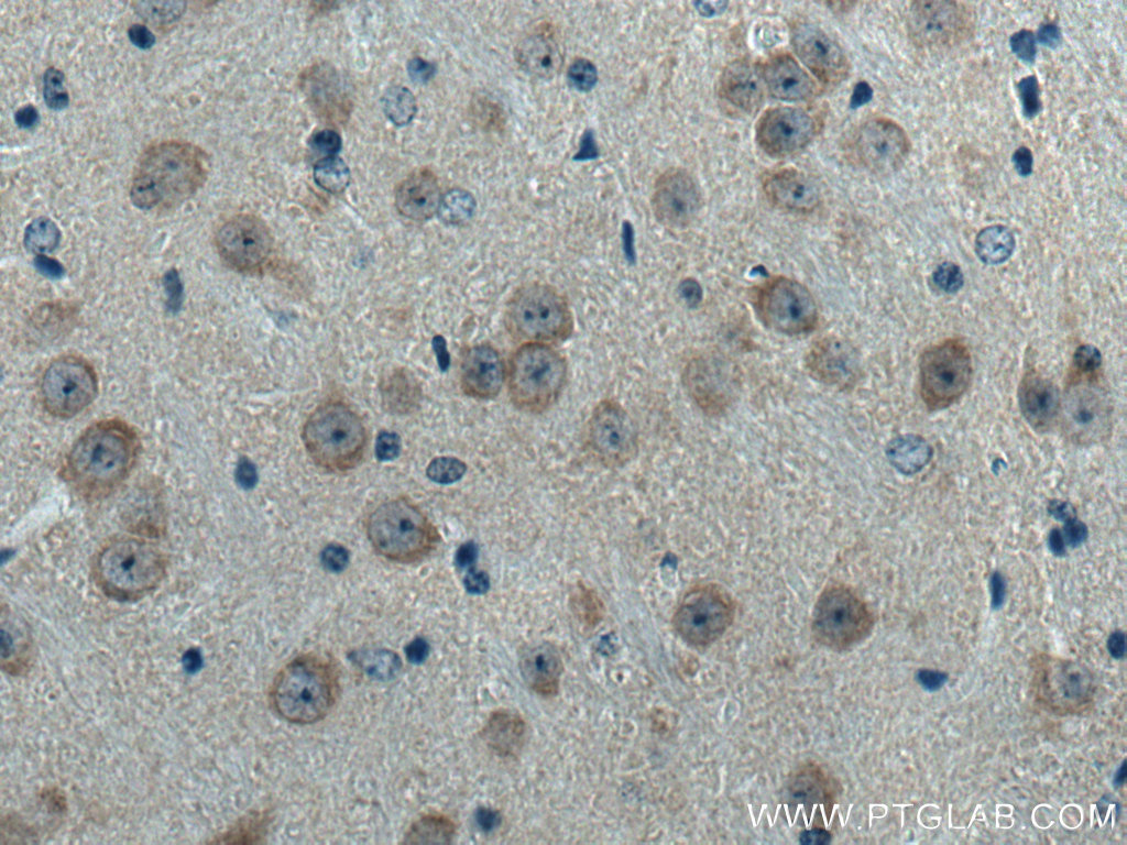 IHC staining of mouse brain using 10162-1-AP