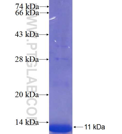 C17orf91 fusion protein Ag23568 SDS-PAGE