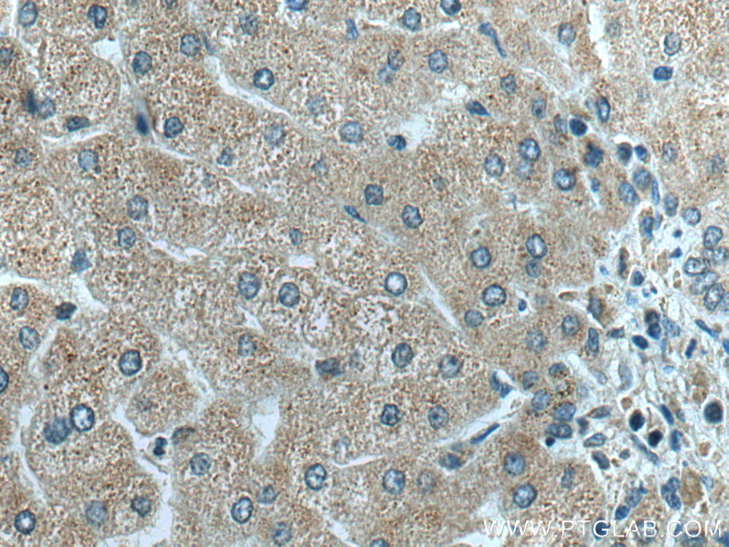 IHC staining of human liver using 16641-1-AP