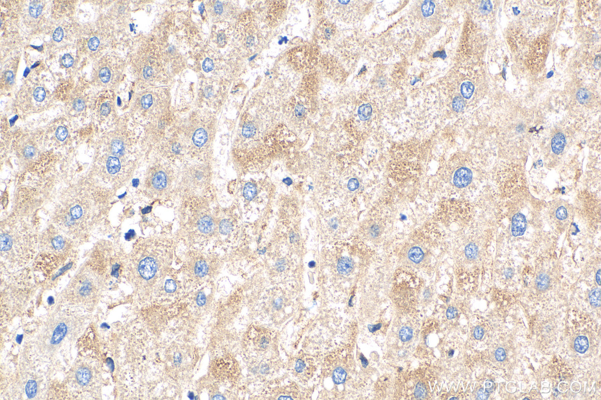 IHC staining of human liver using 16641-1-AP