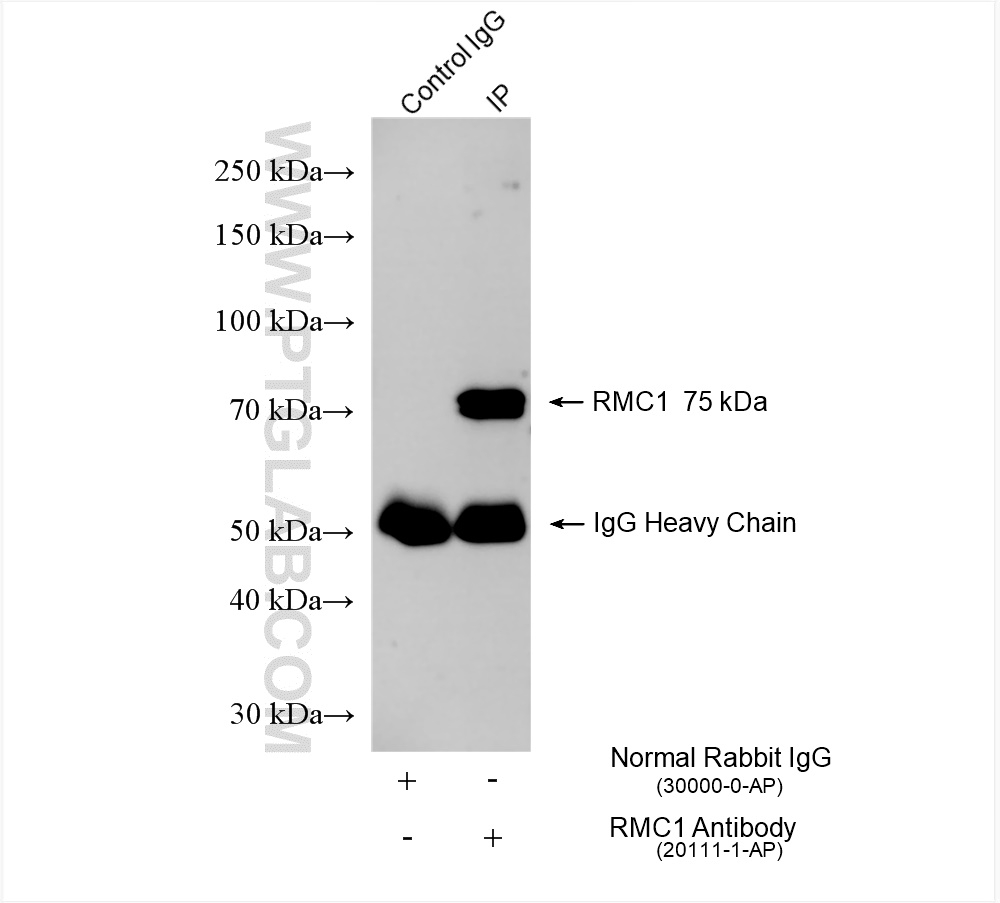 IP experiment of MCF-7 using 20111-1-AP