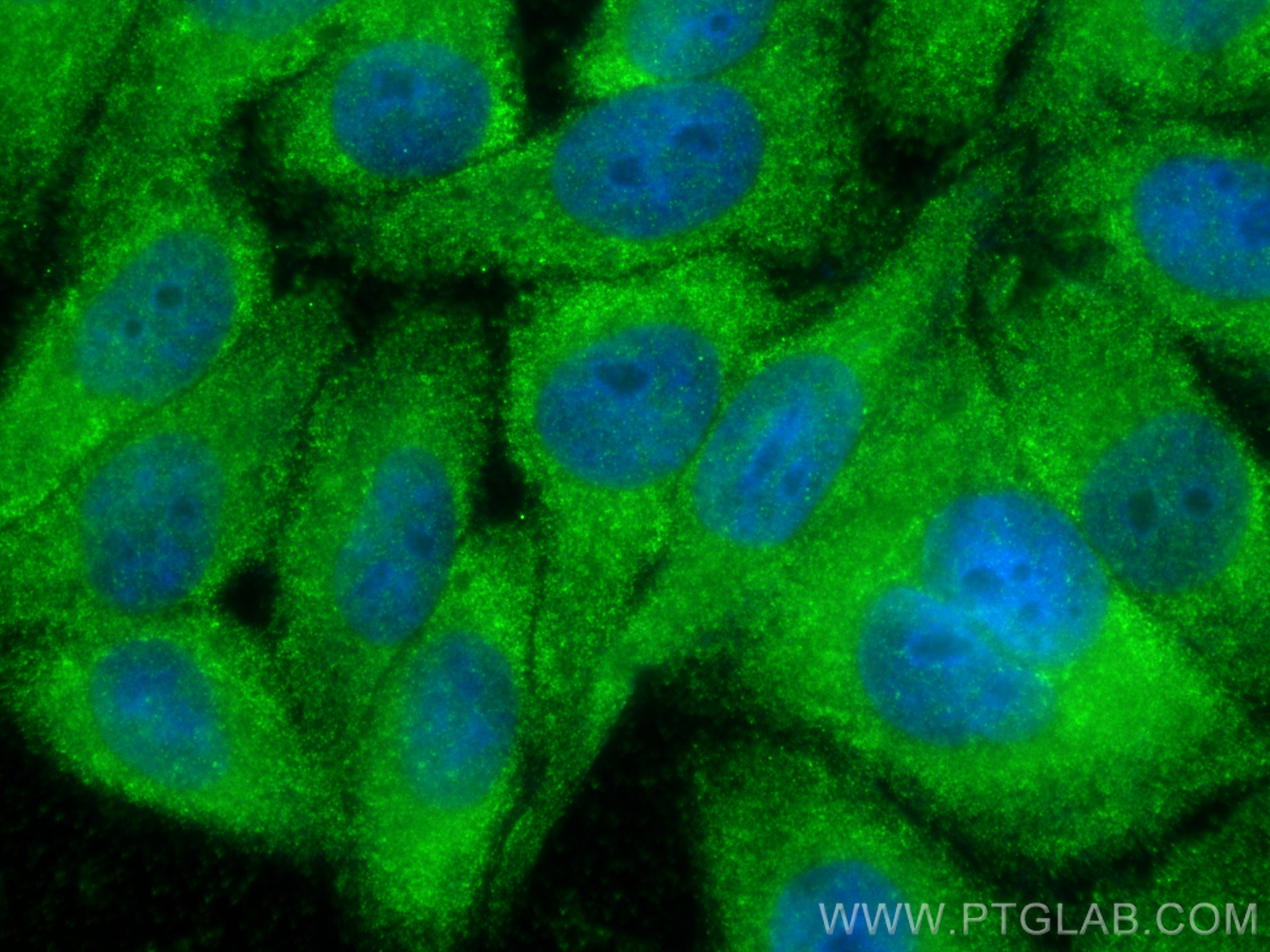 IF Staining of HepG2 using 11353-1-AP