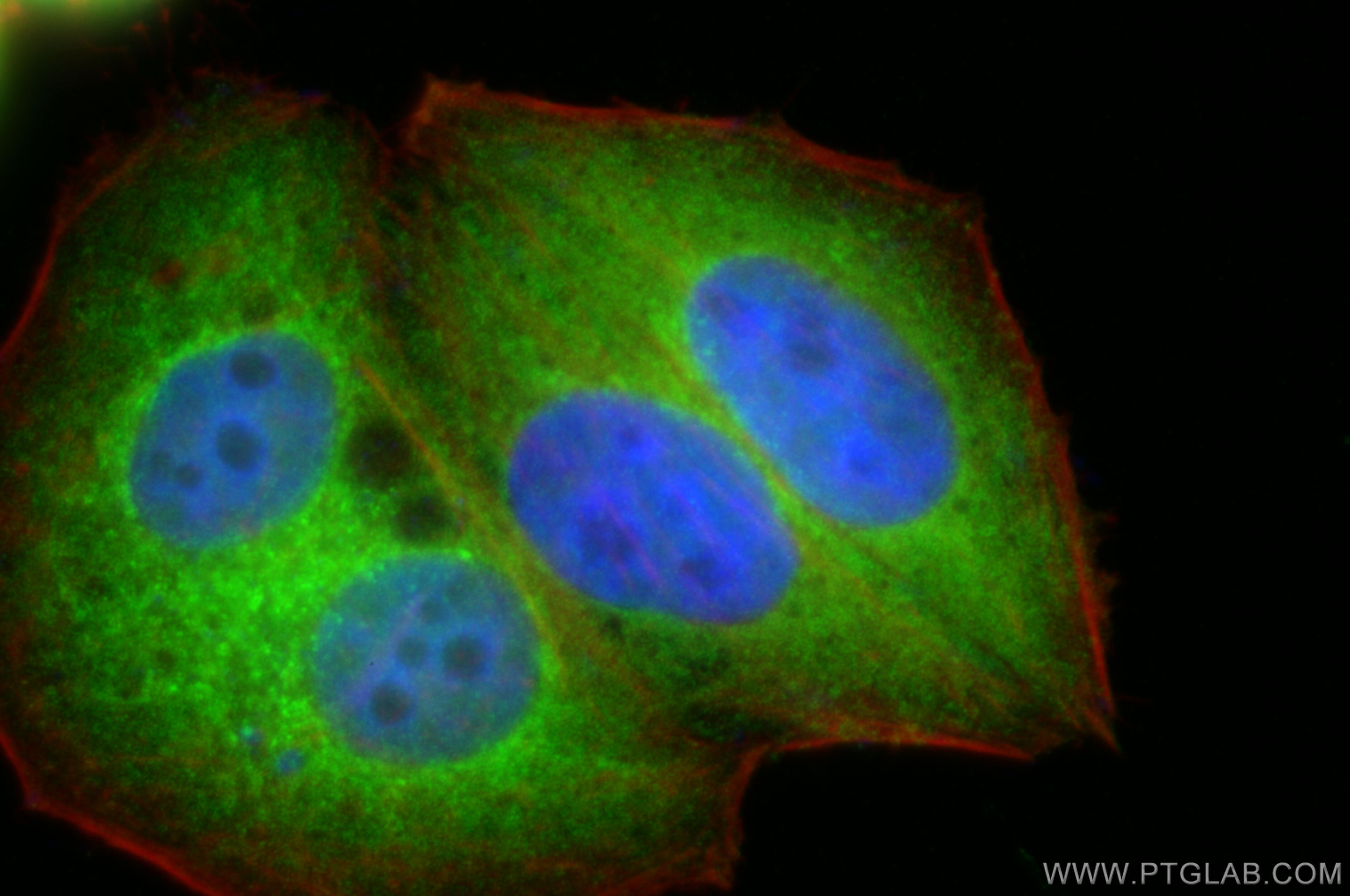 IF Staining of HepG2 using 25650-1-AP