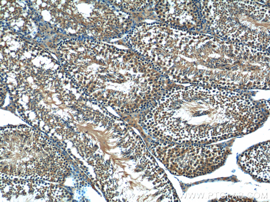 IHC staining of mouse testis using 25650-1-AP