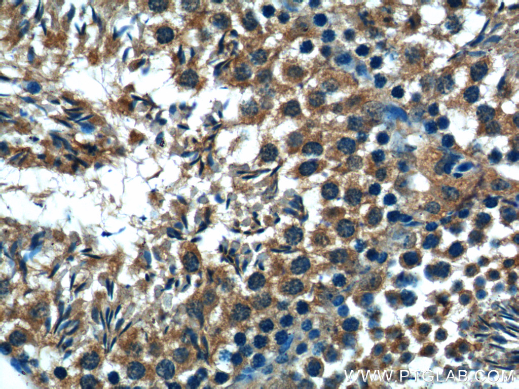 IHC staining of mouse testis using 25650-1-AP