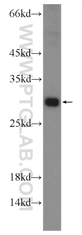 WB analysis of mouse testis using 25650-1-AP