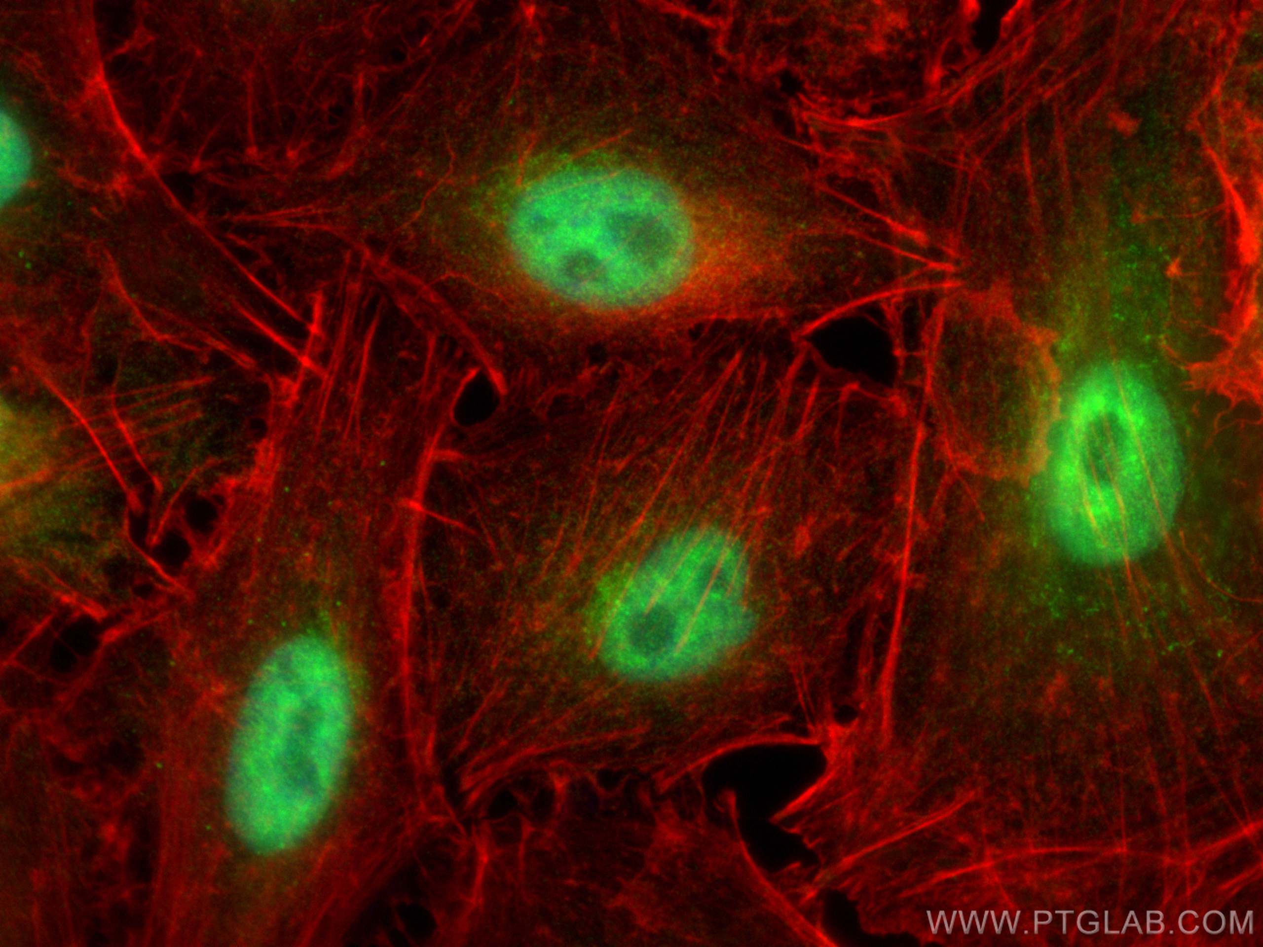 IF Staining of A549 using 26431-1-AP