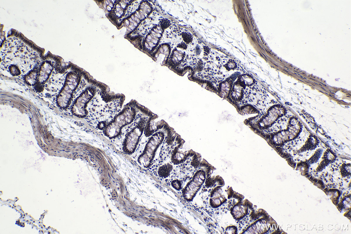 IHC staining of rat colon using 19420-1-AP