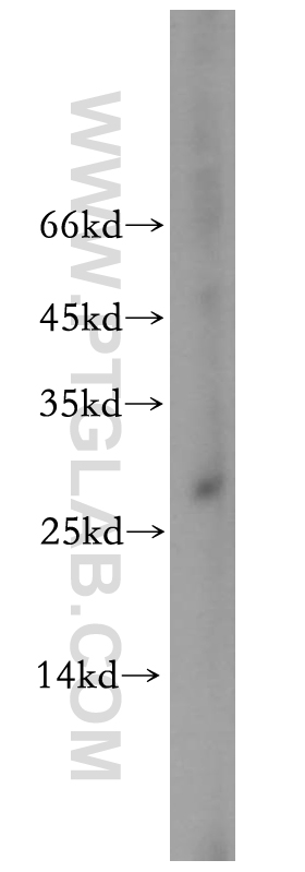 WB analysis of A431 using 19420-1-AP