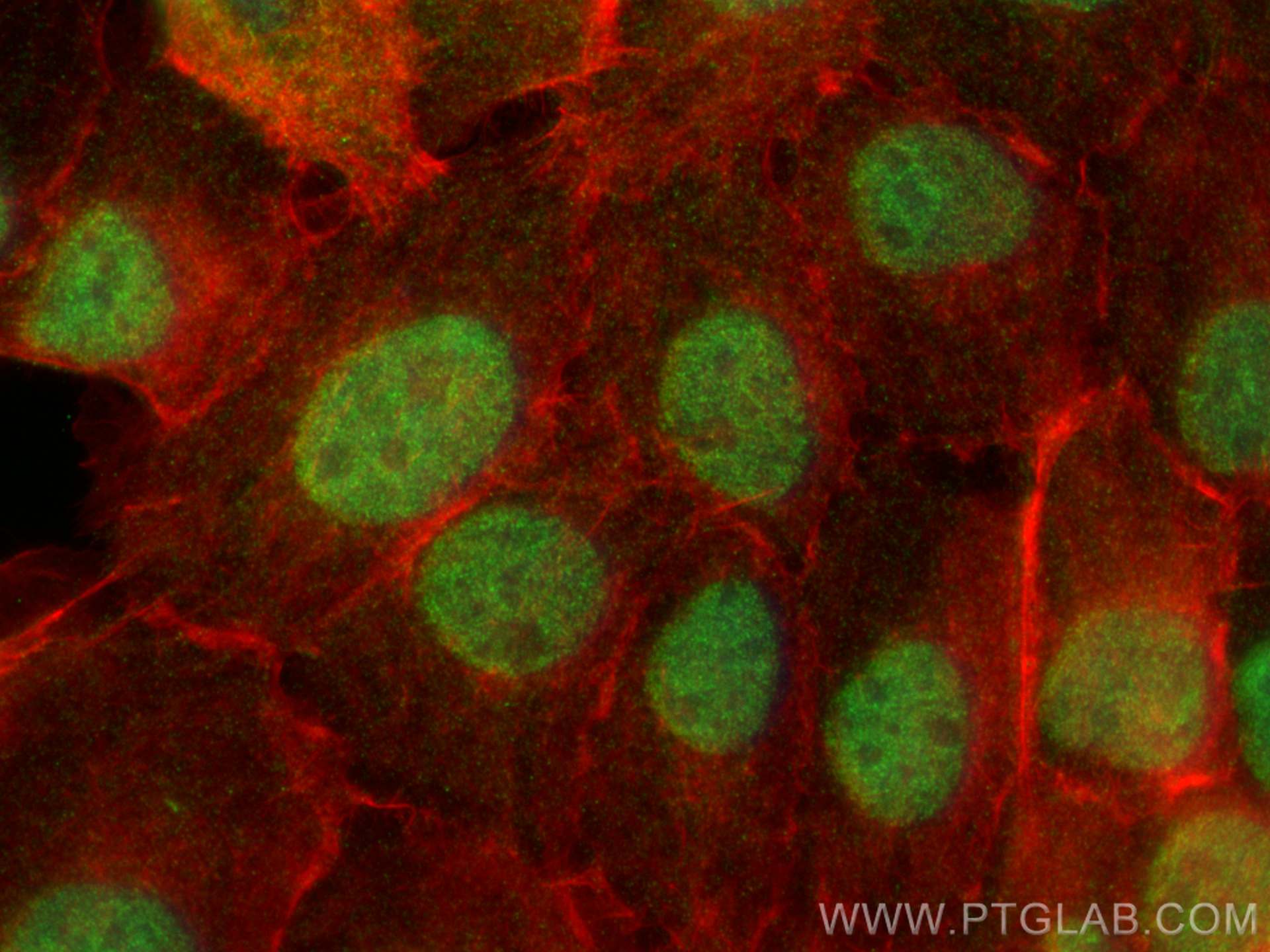 IF Staining of A431 using 25050-1-AP