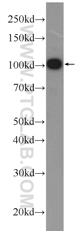 WB analysis of PC-3 using 25050-1-AP