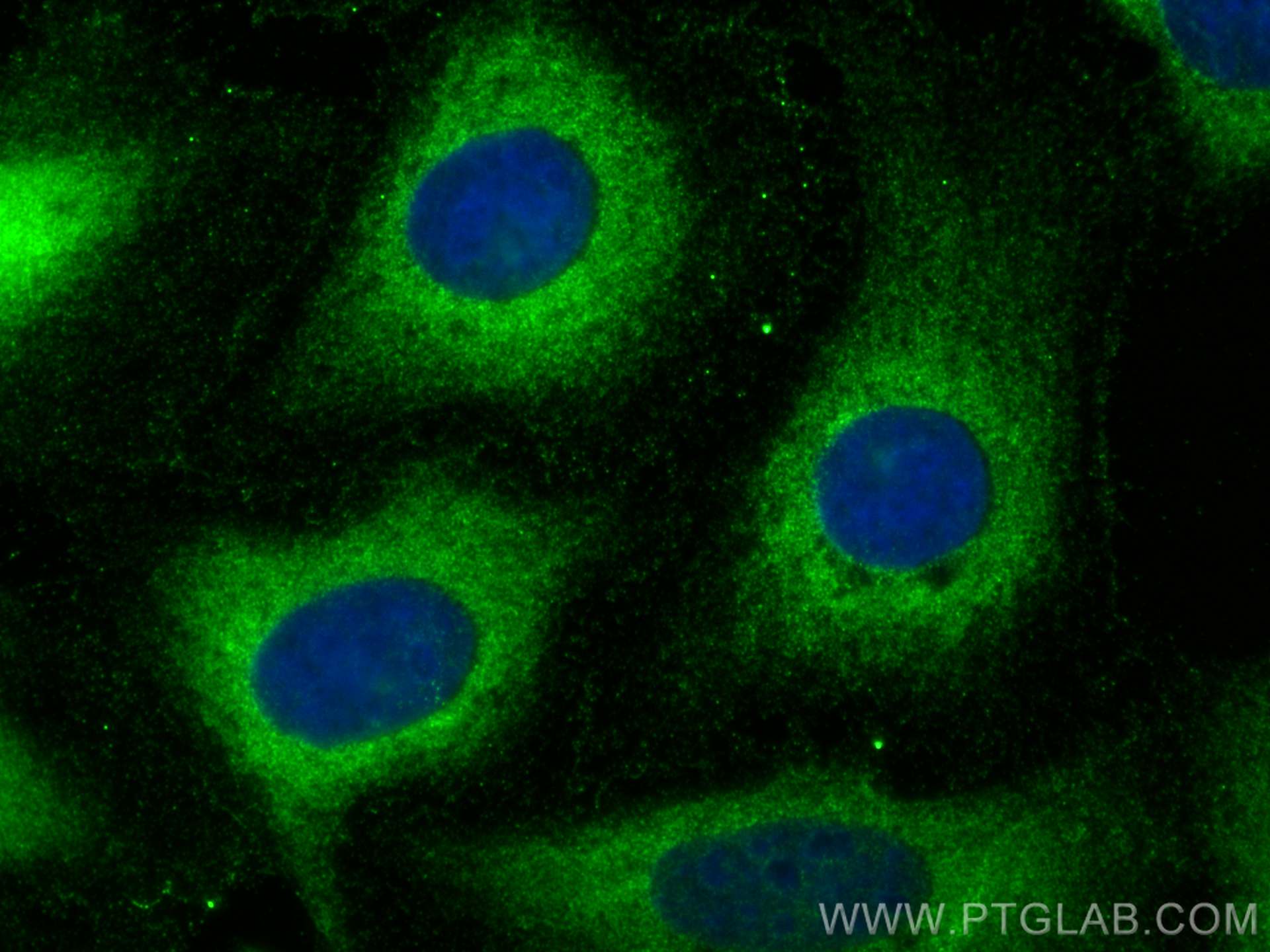 IF Staining of U2OS using 24797-1-AP