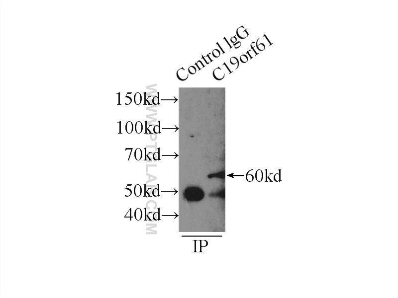 IP experiment of HeLa using 24797-1-AP