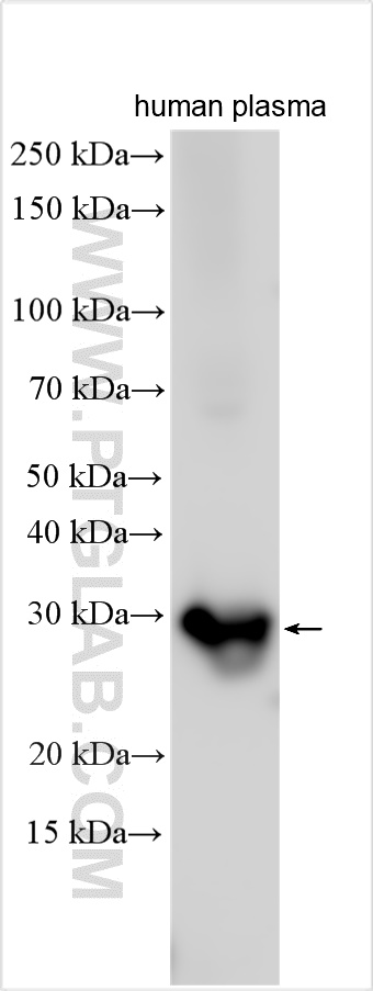 WB analysis using 11602-1-AP