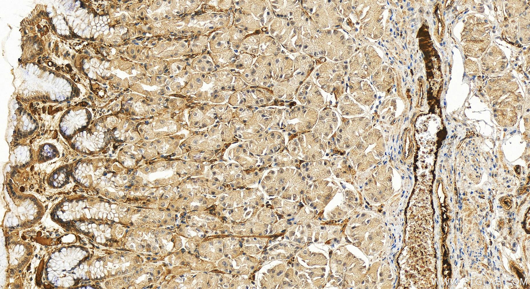 IHC staining of human stomach using 16919-1-AP