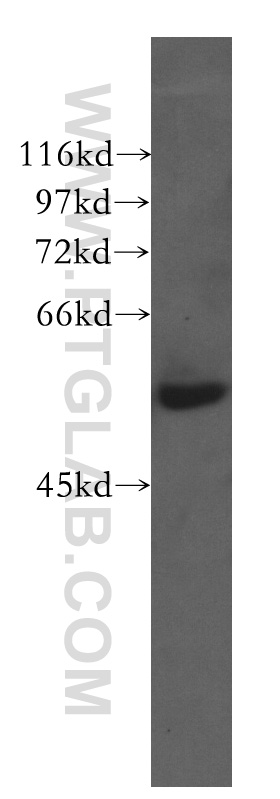 WB analysis of HeLa using 51030-1-AP