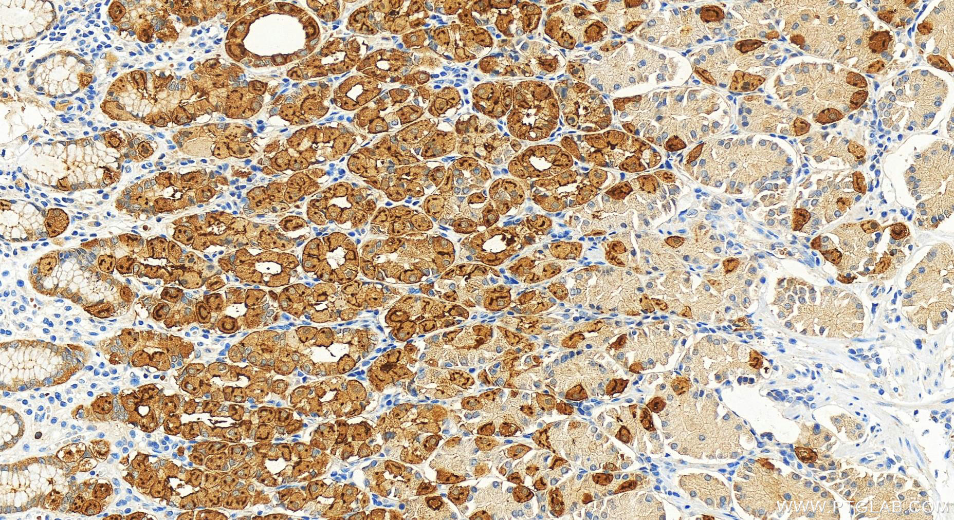 IHC staining of human stomach using 14888-1-AP