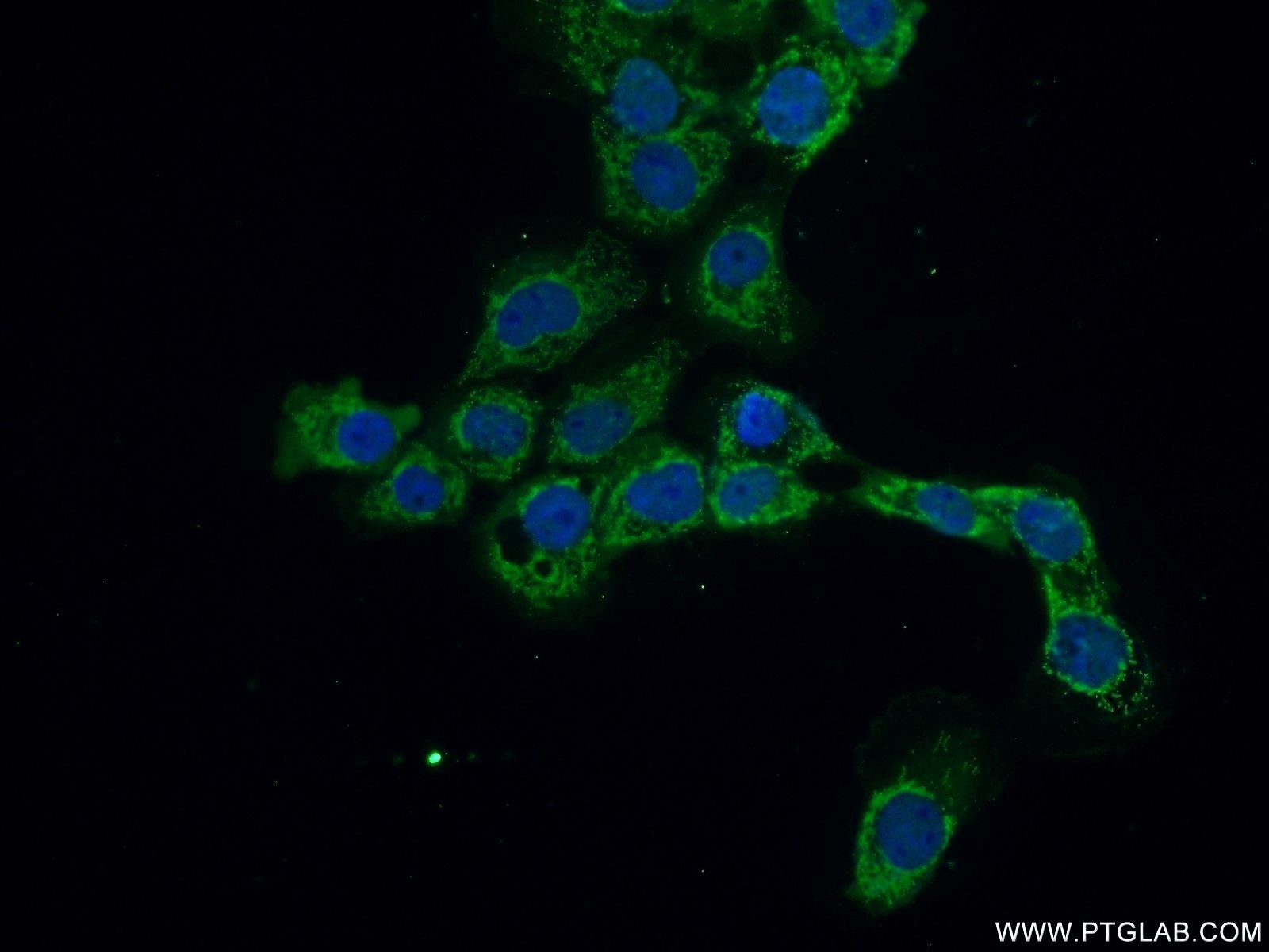 IF Staining of A431 using 25553-1-AP