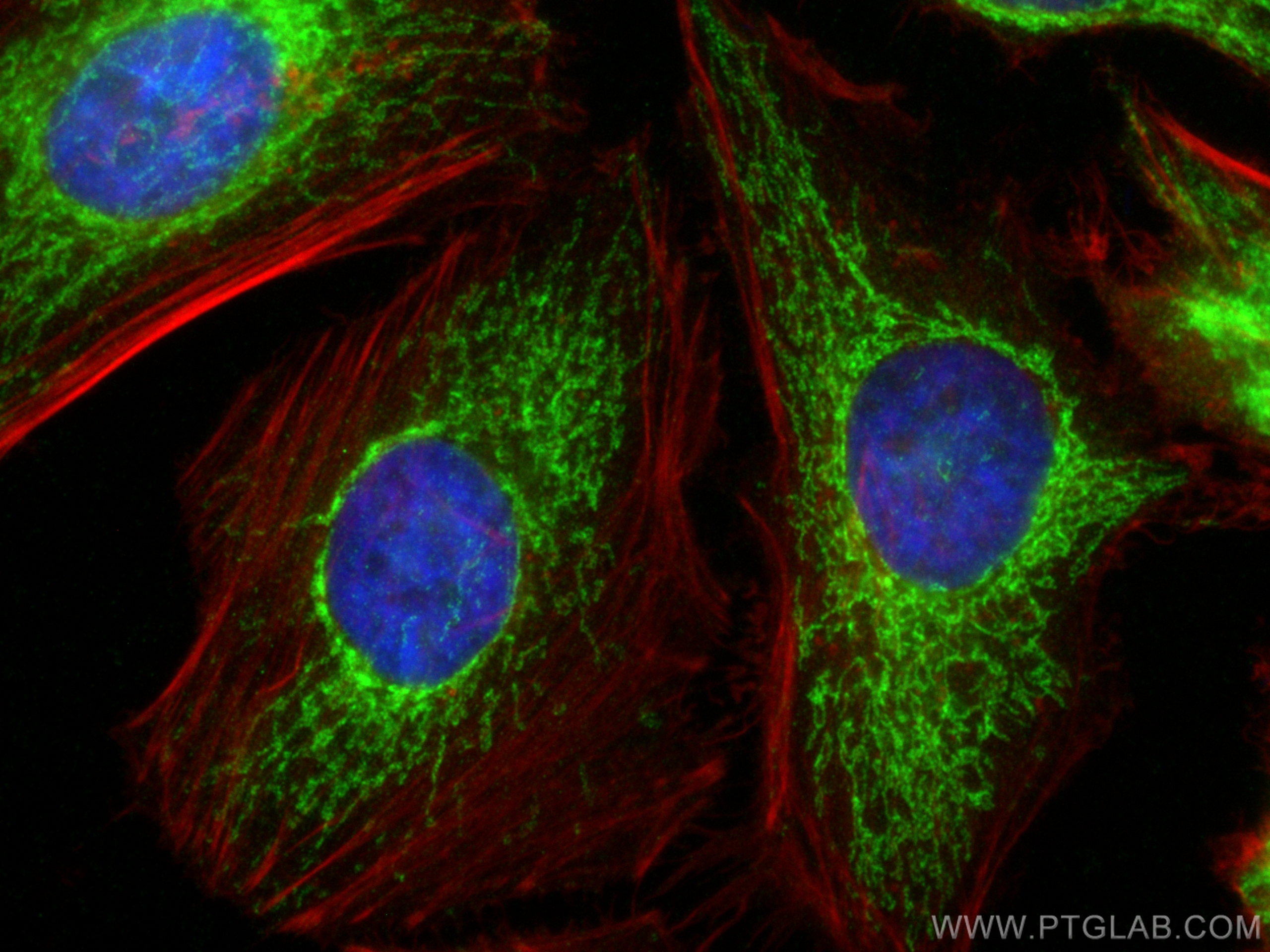 IF Staining of HeLa using 25361-1-AP