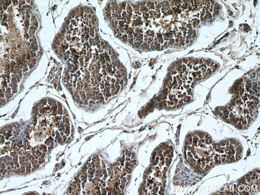 IHC staining of human testis using 24429-1-AP