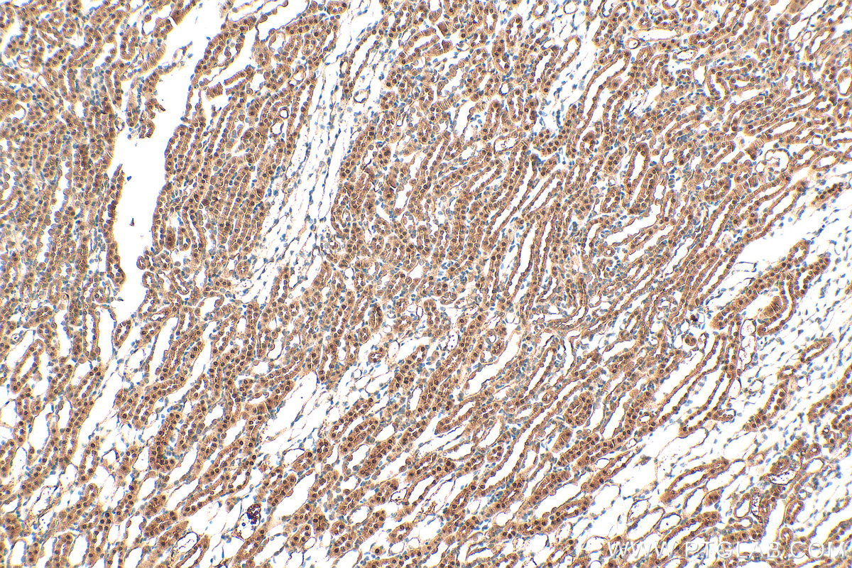 IHC staining of mouse kidney using 20957-1-AP