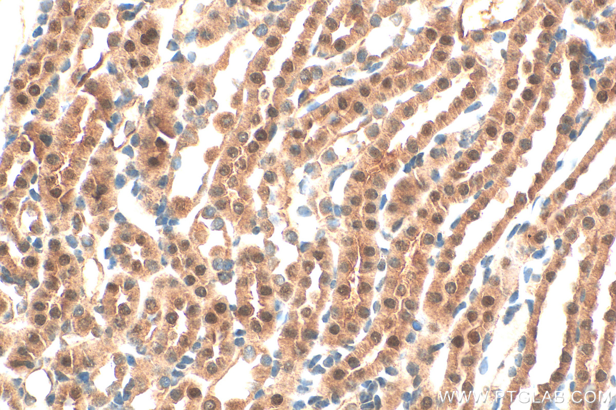 IHC staining of mouse kidney using 20957-1-AP