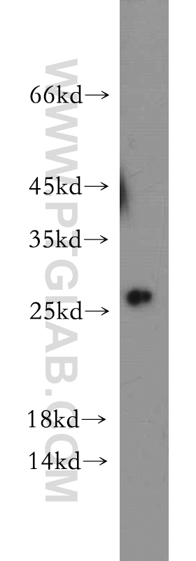 WB analysis of HEK-293 using 20957-1-AP