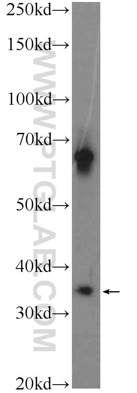 WB analysis of mouse testis using 25433-1-AP