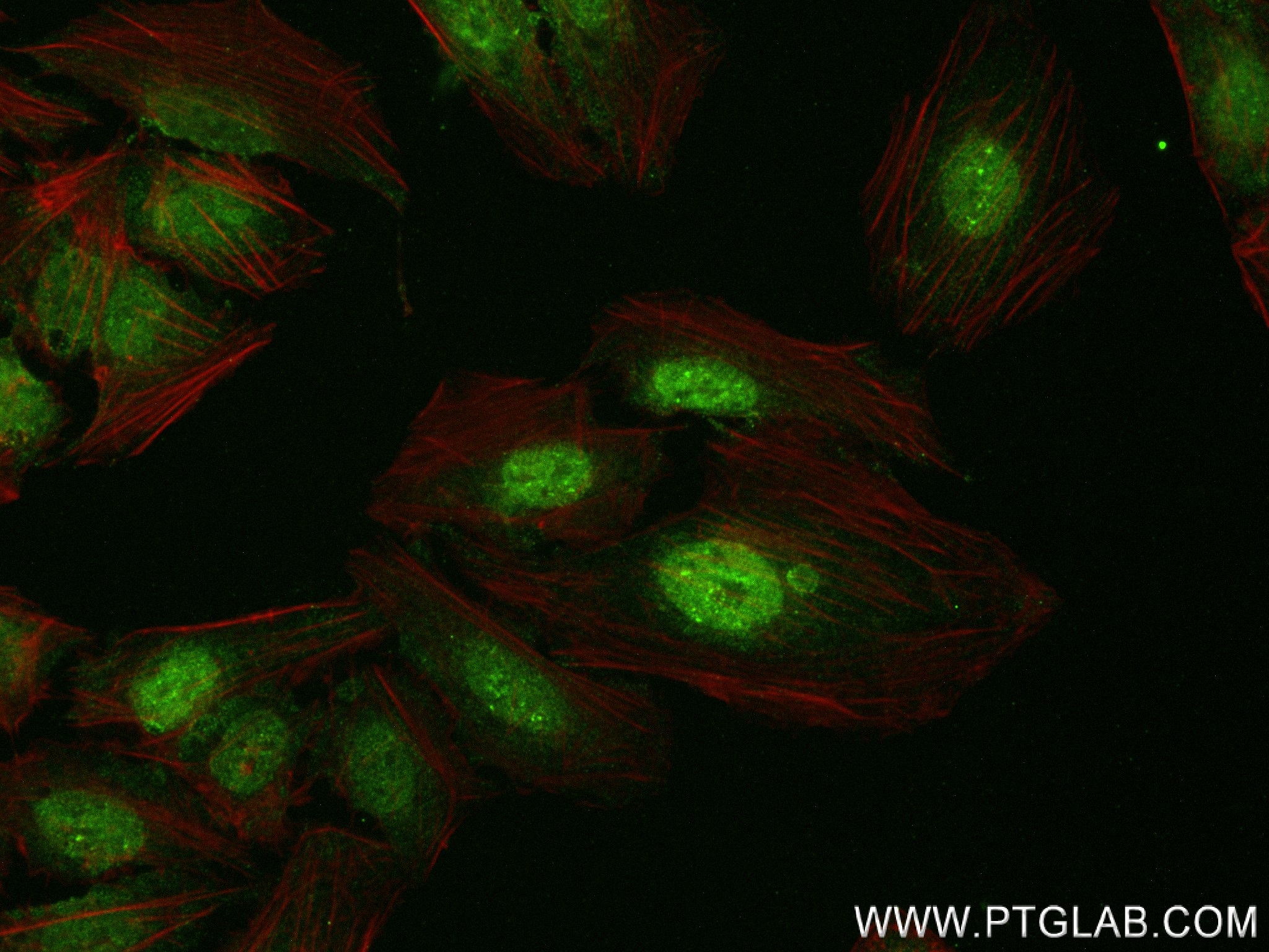 IF Staining of U2OS using 83626-5-RR (same clone as 83626-5-PBS)