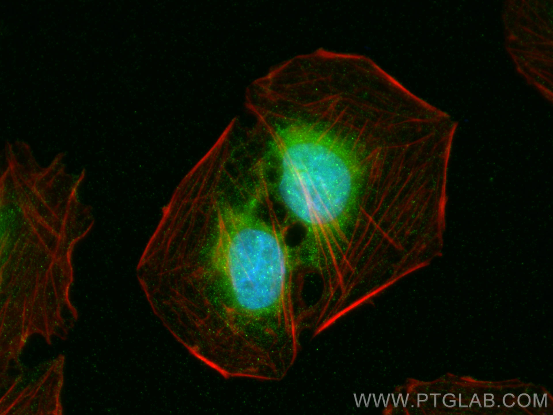 IF Staining of U2OS using 19912-1-AP