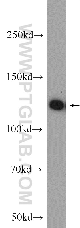 WB analysis of mouse testis using 23184-1-AP