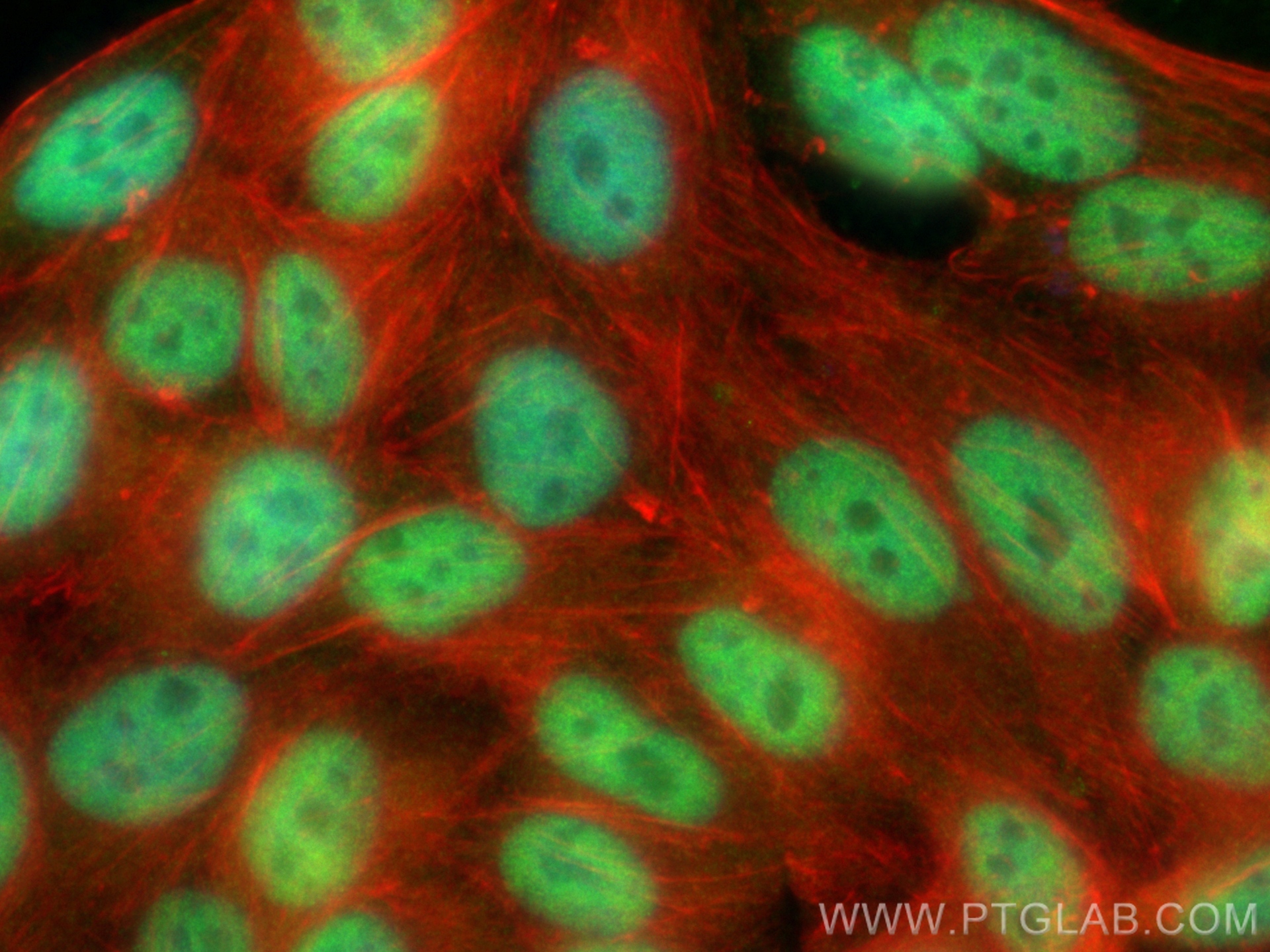 IF Staining of HepG2 using 26040-1-AP