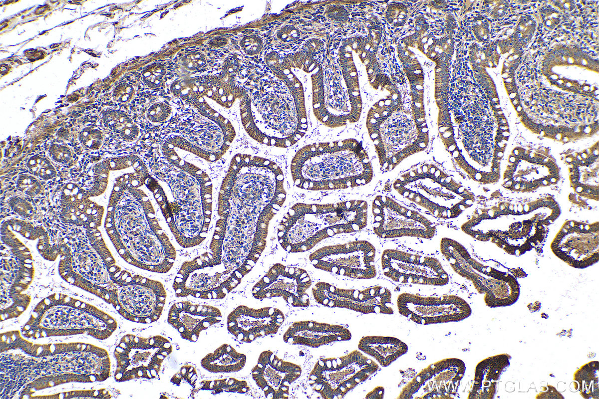 IHC staining of human small intestine using 25626-1-AP