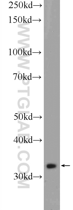 WB analysis of K-562 using 21461-1-AP