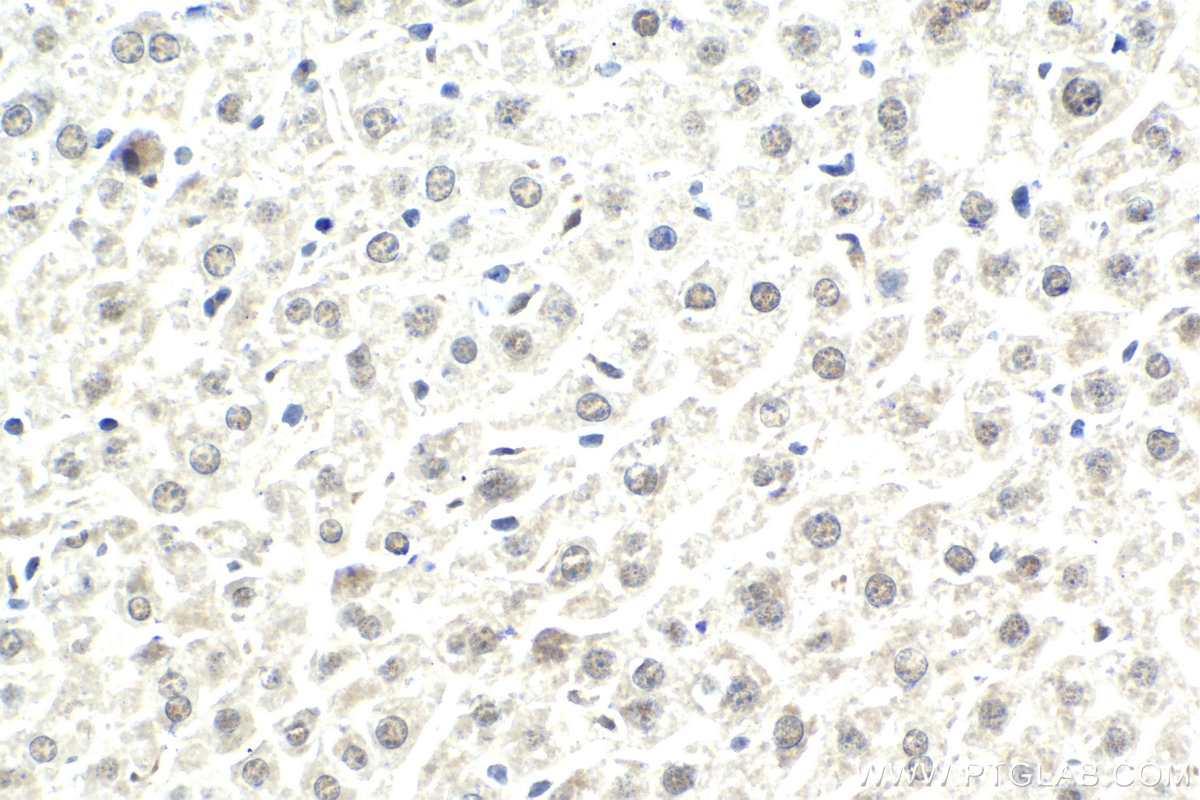 IHC staining of mouse liver using 21357-1-AP