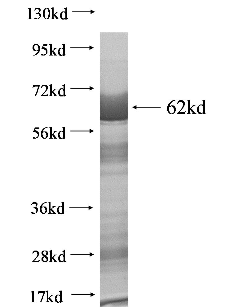 C22orf28 fusion protein Ag0569 SDS-PAGE