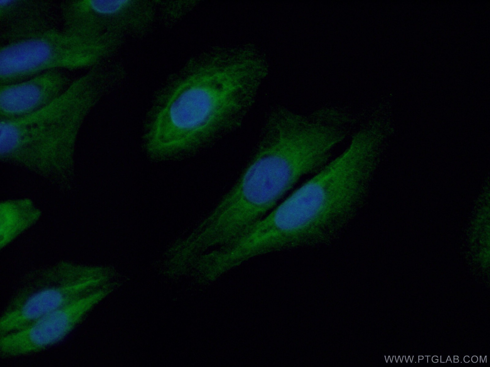 IF Staining of U2OS using 26577-1-AP