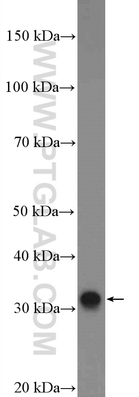 WB analysis of human testis using 26577-1-AP