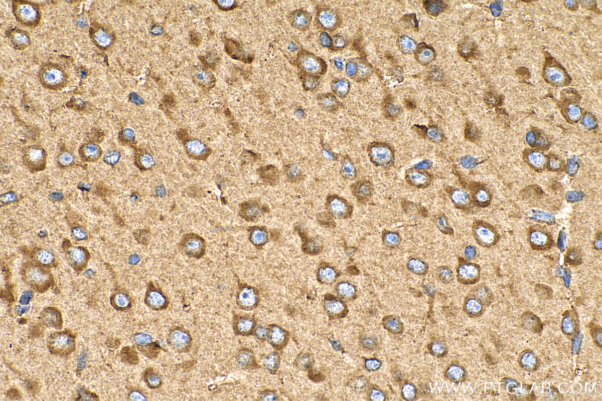 IHC staining of mouse brain using 29773-1-AP