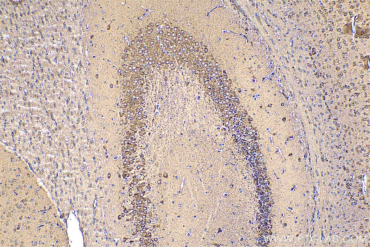 IHC staining of mouse brain using 29773-1-AP