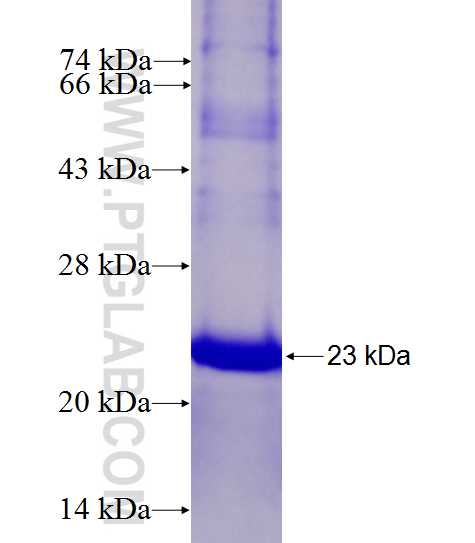 C2orf34 fusion protein Ag27568 SDS-PAGE