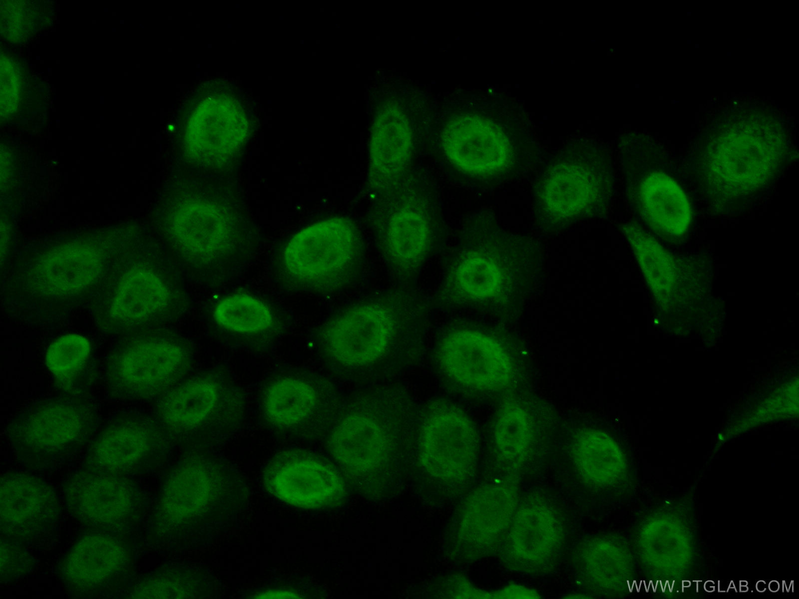 IF Staining of A431 using 18272-1-AP