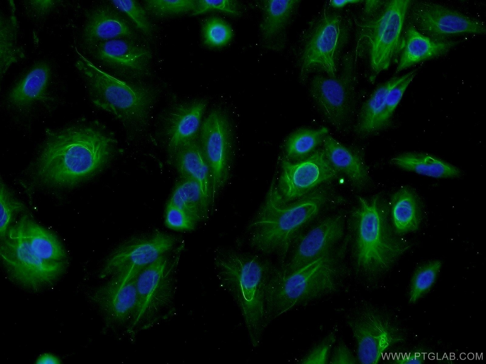 IF Staining of A549 using 24183-1-AP