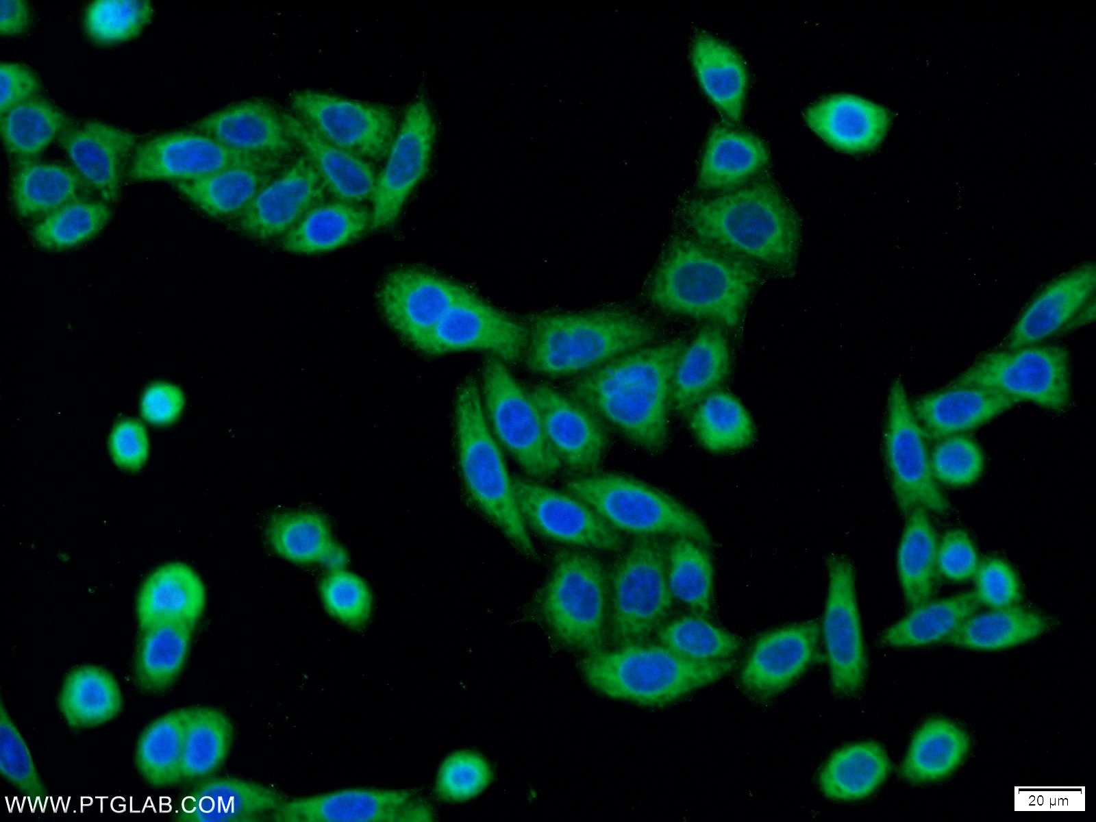 IF Staining of HeLa using 20913-1-AP