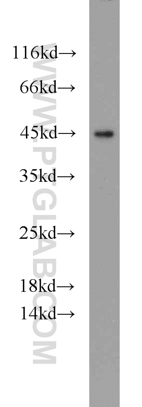 WB analysis of HeLa using 20913-1-AP