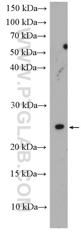 WB analysis of mouse kidney using 26036-1-AP