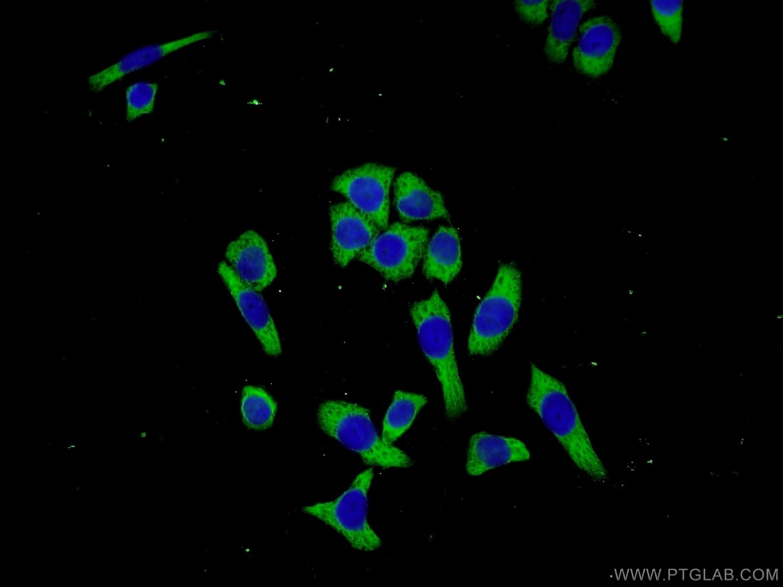 IF Staining of L02 using 25510-1-AP